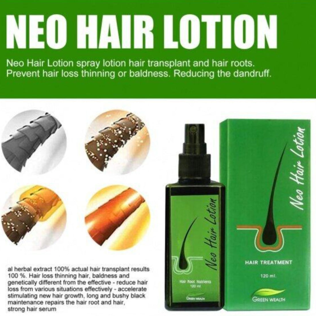 Neo Hair Lotion 120ml Hair Treatment Hair Root Nutrients Anti-Loss